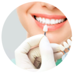 Blanqueamiento Dental