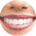 Diseño de Sonrisa